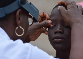 WHO validates Malawi for eliminating trachoma, first country in southern Africa