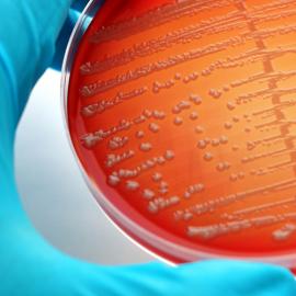Antimicrobial Resistance