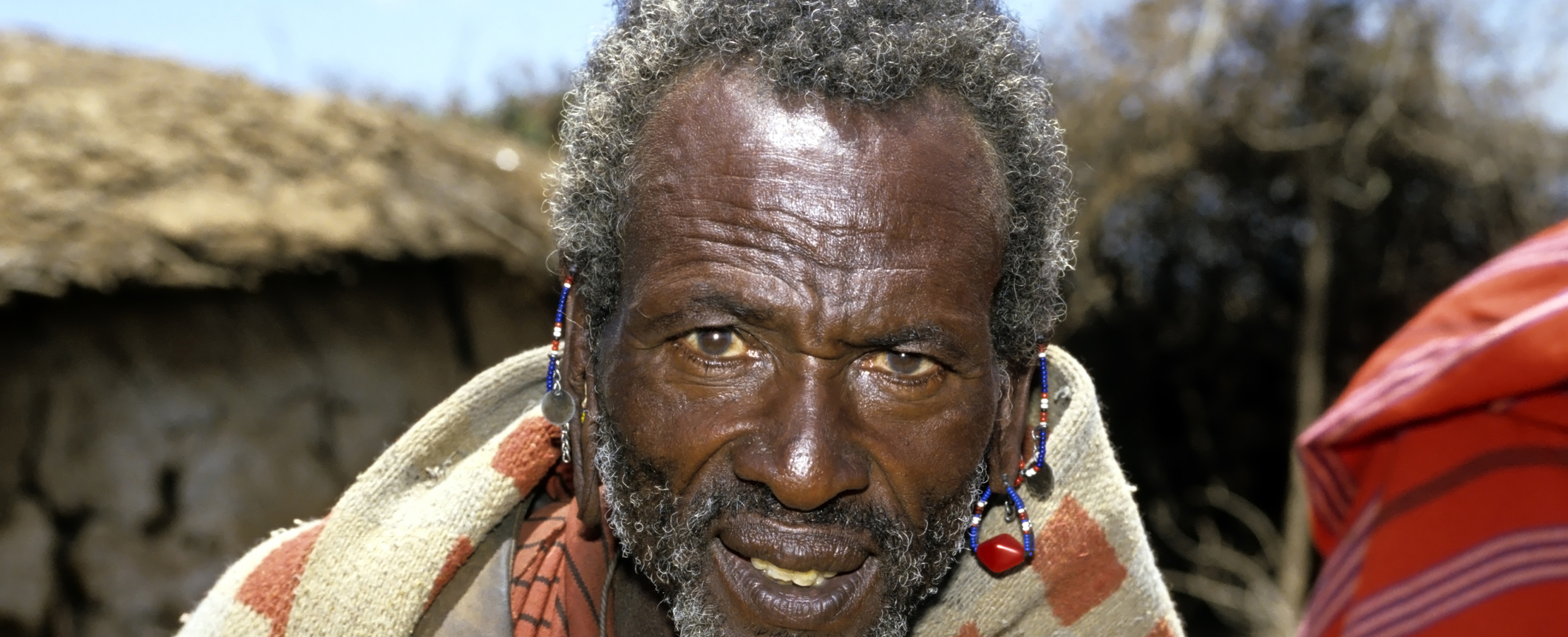 Hepatitis WHO Regional Office for Africa