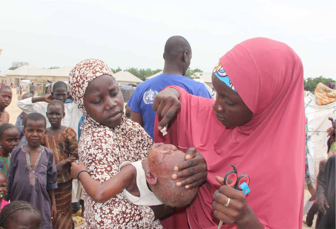 Adamawa conducts first vaccination campaign in response to cholera outbreak | WHO | Regional ...