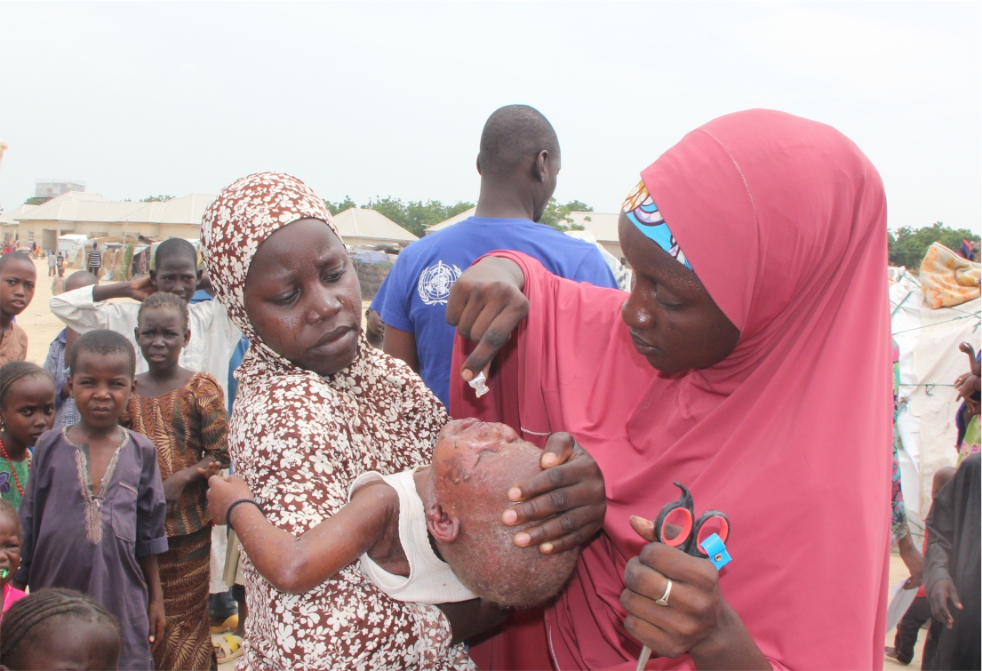 A child receiving  while other  people queue up for OCV