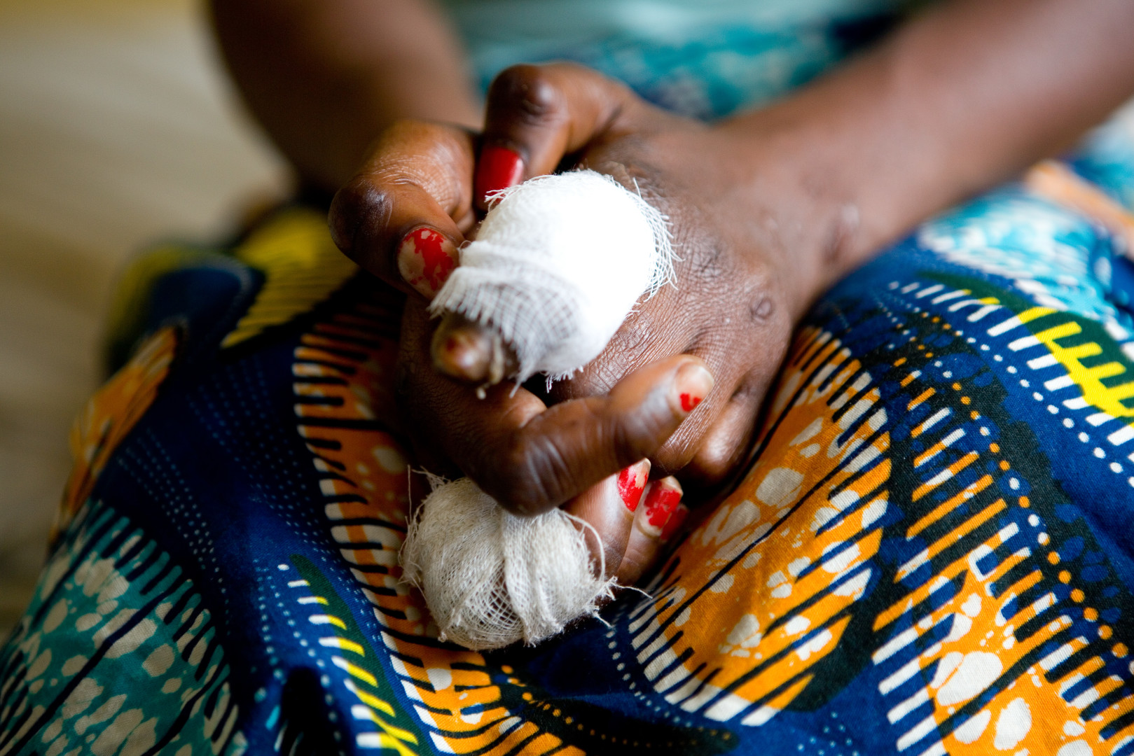En République démocratique du Congo, la lutte contre la lèpre stimulée par une meilleure détection des cas