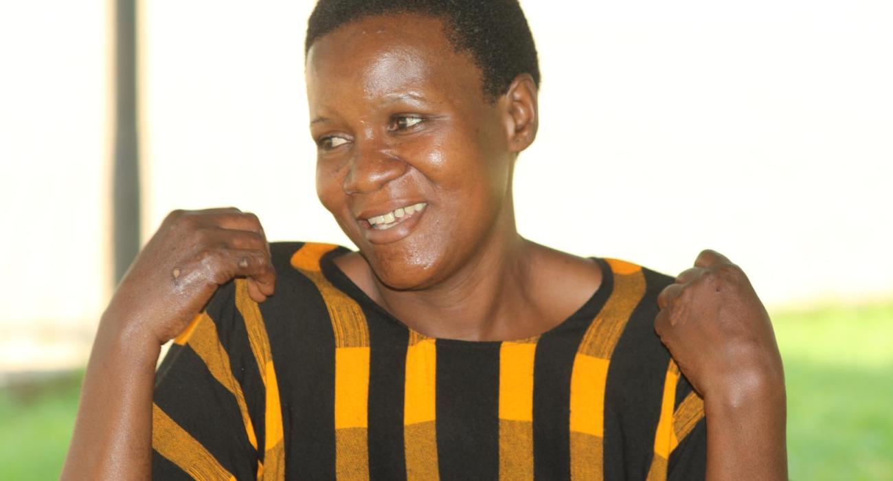 Minsa Bakimenze displays Leprosy sore on her hands