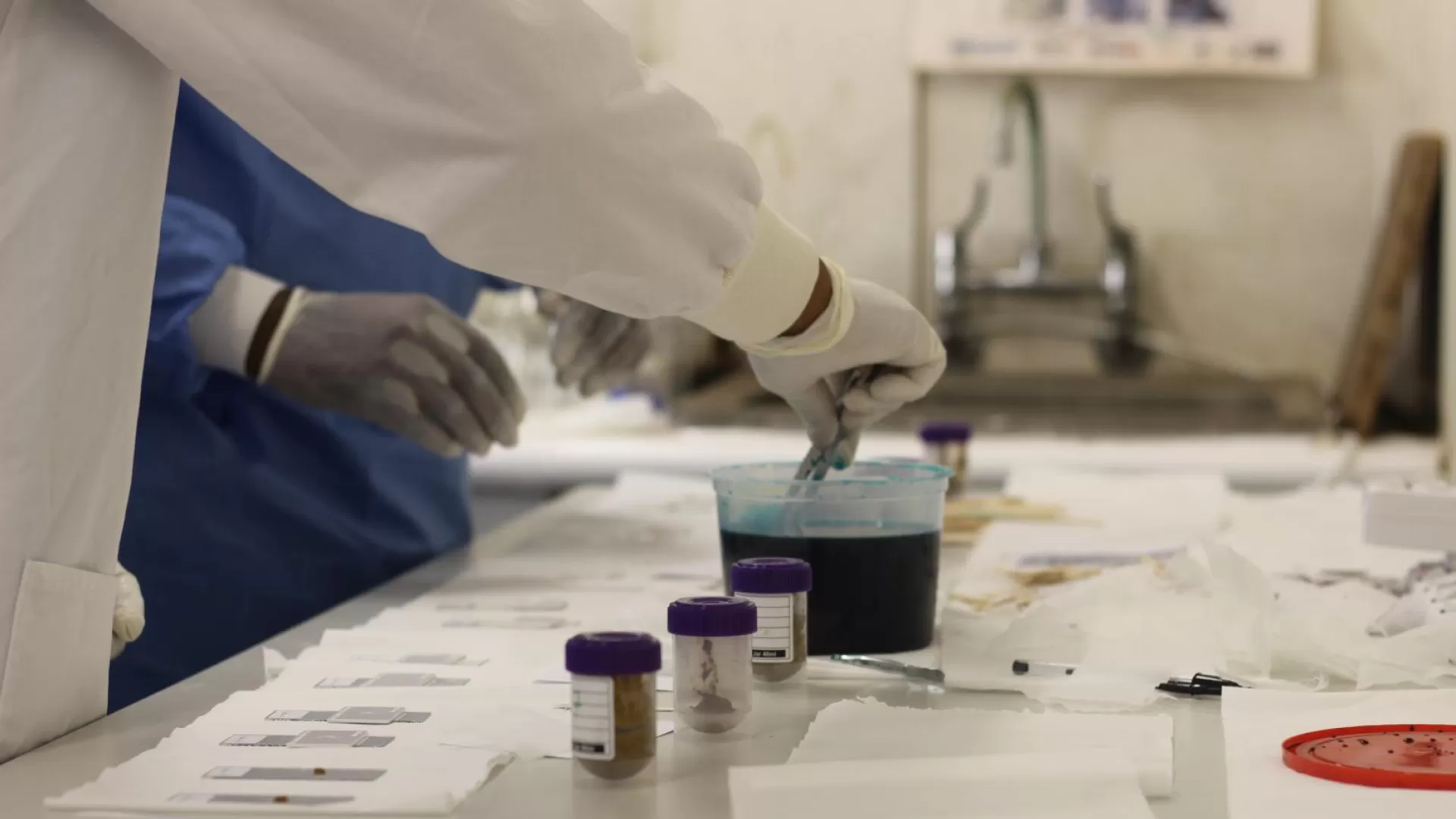 Why Botswana needs a comprehensive laboratory policy and strategic plan? 