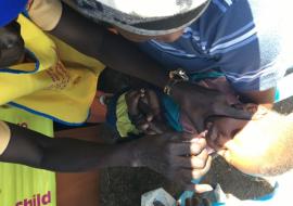 A child being vaccinated against polio in Juba
