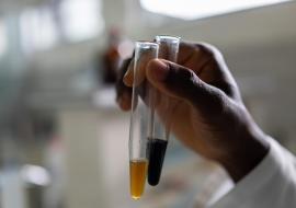 WHO, Africa CDC in joint push for COVID-19 traditional medicine research in Africa