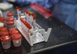 Six in seven COVID-19 infections go undetected in Africa