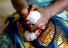 Better testing boosts leprosy response in the Democratic Republic of the Congo