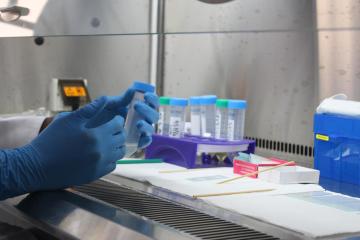 Strengthening laboratory capacity revolutionizes TB treatment in Congo thumbnail