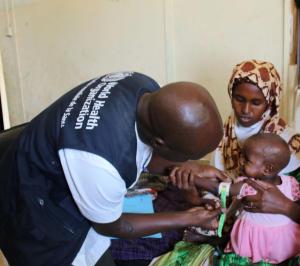 Ethiopia sets new standards for the management of acute malnutrition