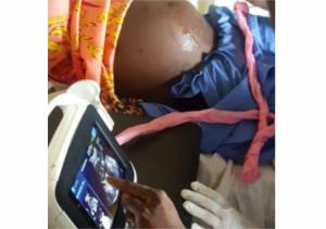 A rural health worker performing an ultrasound.jpg