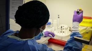 La République démocratique du Congo déclare une flambée de méningite dans une province du Nord-Est.