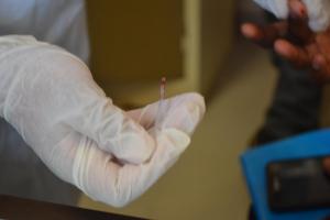 Rapid test for Hepatitis E at the point of care 