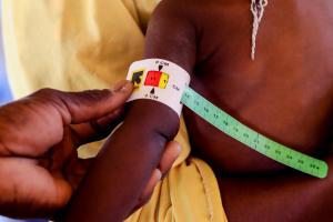 Formation prise en charge malnutrition 