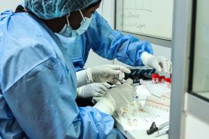 tuberculose