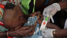 Child being examined for Malnutrition