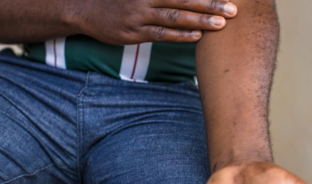 Reinforcing outbreak response systems to curb mpox in Uganda