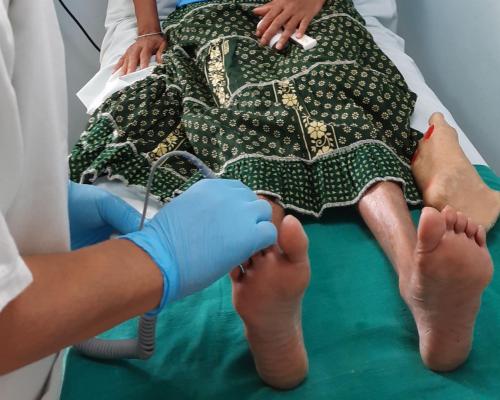 kezelés foot gomba diabetes