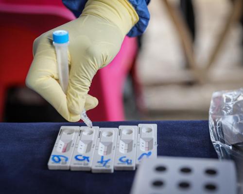 Sudán del Sur se prepara para una mejor respuesta sanitaria | OMS Pruebas RDT para COVID-19
